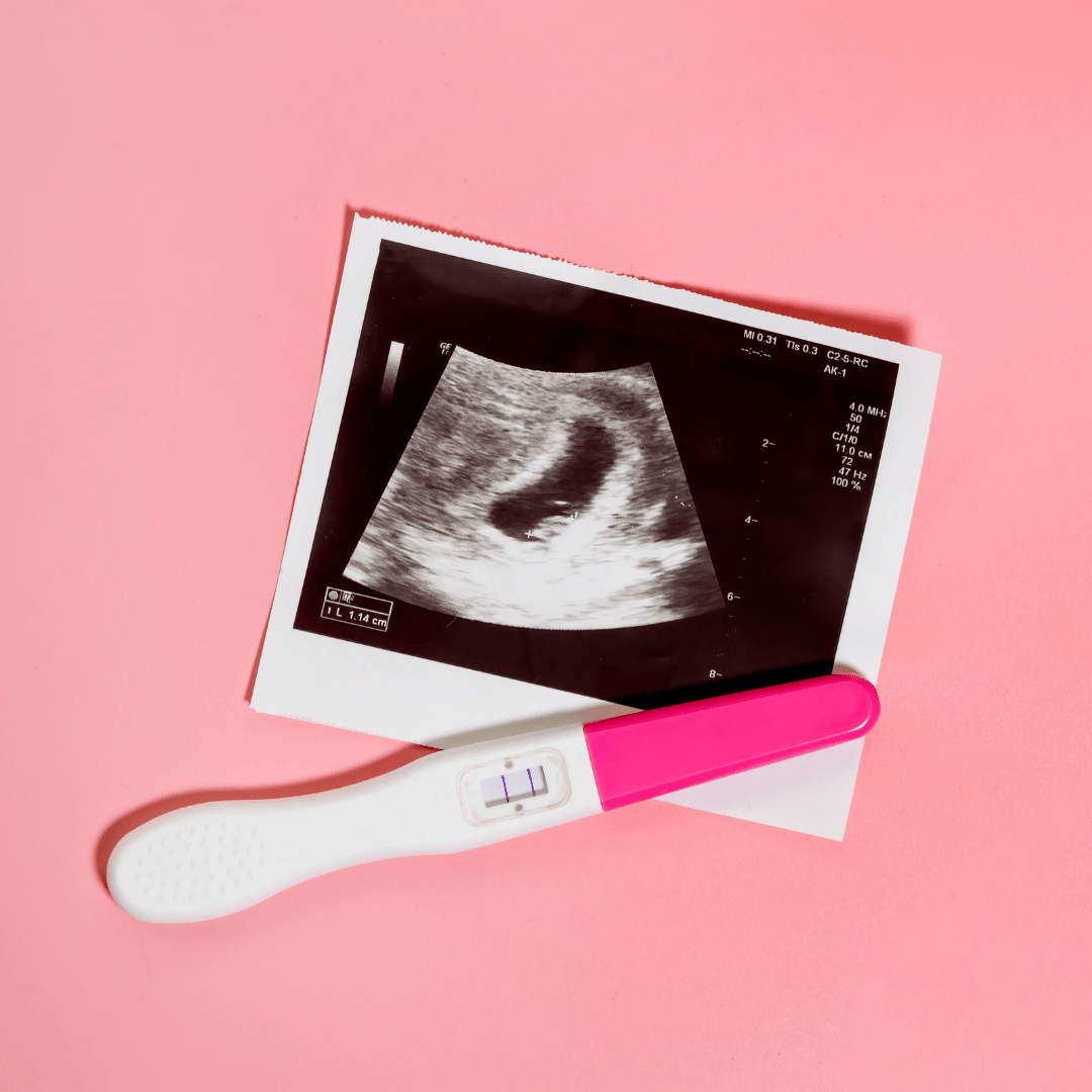 a sonogram of a fetus and a pregnancy test kit