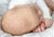 baby with cradle cap the wee bean
